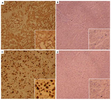 Immunohistochemical Staining For MAPK1 And NCOA2 Original