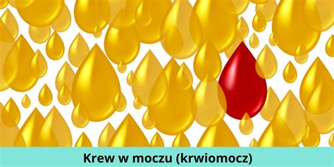 Krew W Moczu Krwiomocz Przyczyny Objawy Co Oznacza