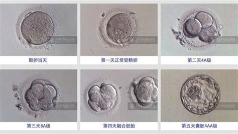 答疑解惑｜囊胚移植成功率高是真的嗎？培養囊胚有什麼要求？ 每日頭條