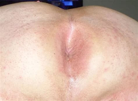 My Ass Ready For A Cock Nude Pics XHamster