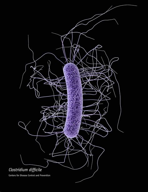C Difficile - Resume Themplate Ideas