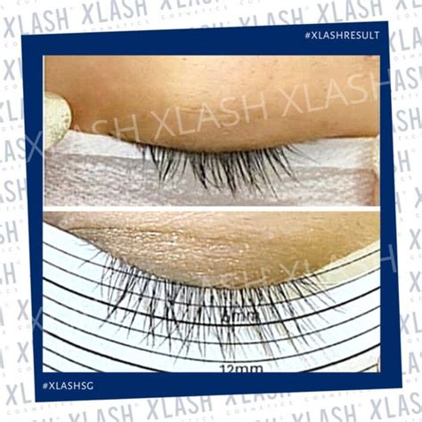 XLASH PRO Lash Serum 6ml - Xlash Cosmetics Singapore