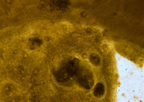 | Fish Pathogens