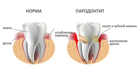 Учебный центр для стоматологов | Victoria Bental | Пародонтология