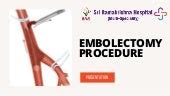 Embolectomy procedure in Coimbatore