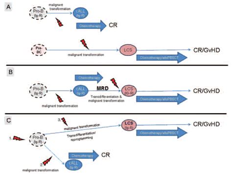 Common Clonal Origin Of An Acute B Lymphoblastic Leukemia And A