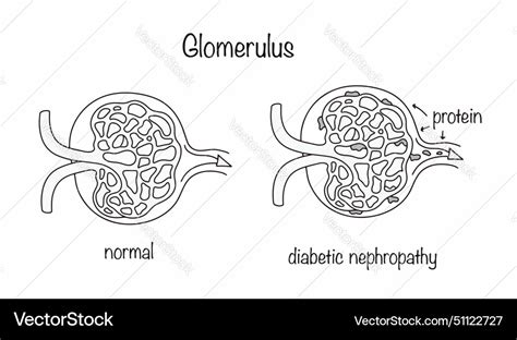 Glomerulus Royalty Free Vector Image Vectorstock