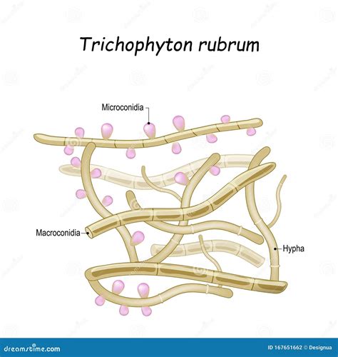 Trichophyton Rubrum. Close-up Of Fungi With Fertile Hyphae, Macroconidia And Microconidia Vector ...