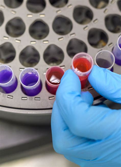 Erythrocyte Sedimentation Rate - Sclavo Diagnostic