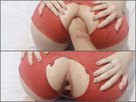 Wife With Ruined Panties Casalfist Gets Fisted Pov Pov Gaping Anal