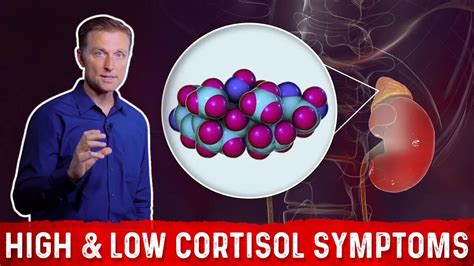 Low Vs High Cortisol Levels Symptoms Explained By Dr Berg