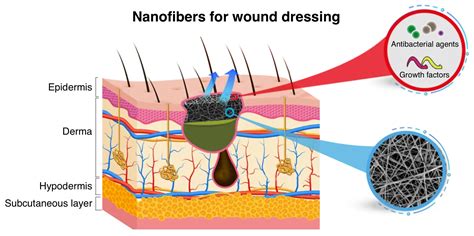 Wound Dressing With Electrospun Core Shell Nanofibers From Material Selection To Synthesis