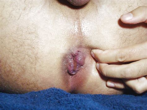 Destroyed Ass Cunt Porn Pictures XXX Photos Sex Images PICTOA