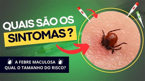 QUAIS SÃO OS SINTOMAS DA FEBRE MACULOSA A Febre Maculosa Qual o