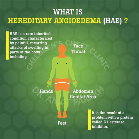 Understanding Angioedema Causes Symptoms And Treatment Ask The