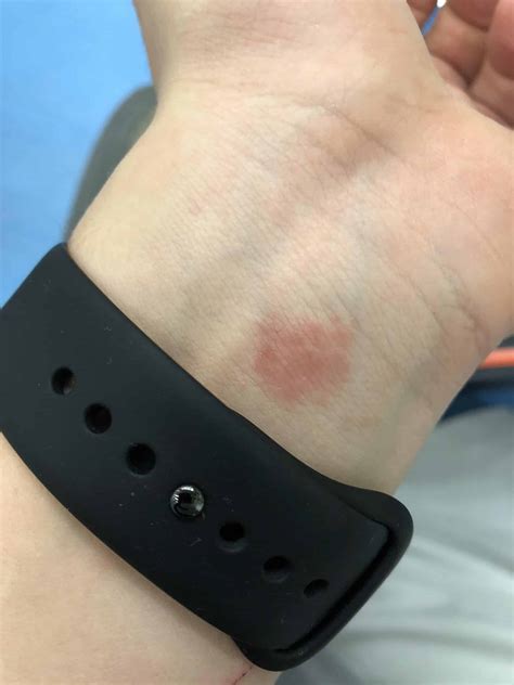 Apple Watch Fast Charging: Overview - GadgetMates
