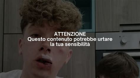 Torino Violenza Fuori Da Una Disco Gay Contro Un Creator Di OnlyFans Nella Notte Di Capodanno