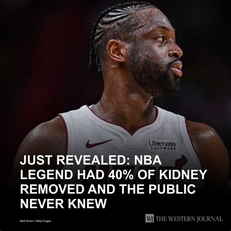 The Tea Party Community by WJ - After removing nearly half of his left