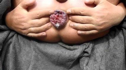 Sesso Anale Estremo Divaricazione Enorme Dildo XHamster