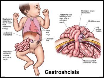 Lecture 7 GI Embryology Histology Flashcards Quizlet