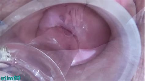 Cervix Fucking Videos XVIDEOS