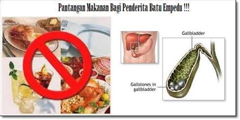 Pantangan Makanan Untuk Penderita Batu Empedu Cara Efektif Hancurkan