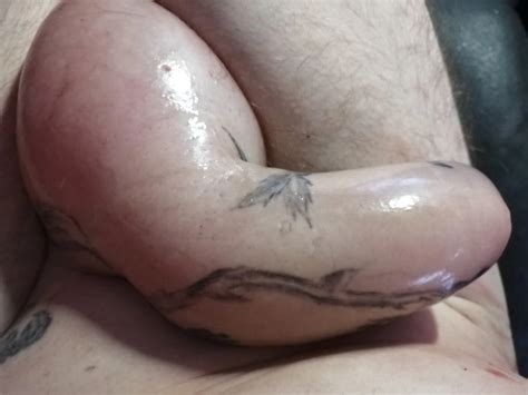 Saline Infusion Scrotum And Titti L Nude Pics XHamster