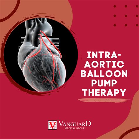 An intra-aortic balloon pump... - Vanguard Medical Group