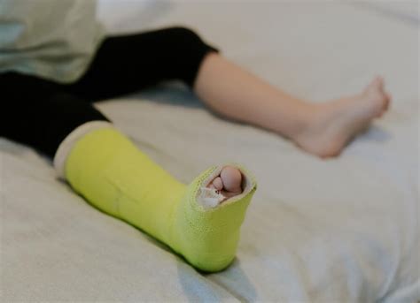 Stress Fractures: Symptoms, Causes, and Effective Treatments