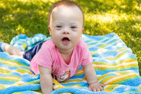report   babies   syndrome  aborted   uk
