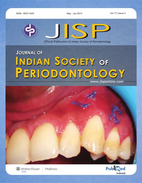 Pdf Understanding The Advances In Biology Of Orthodontic Tooth Movement For Improved Ortho