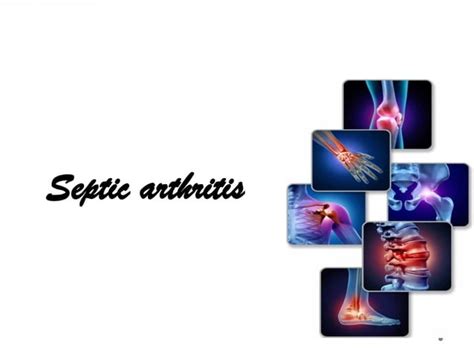 Septic Arthritis Clinical Orthopedicspptx