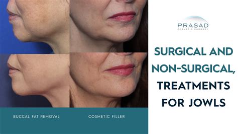 How Loose And Sagging Jowls Can Be Treated With And Without Surgery