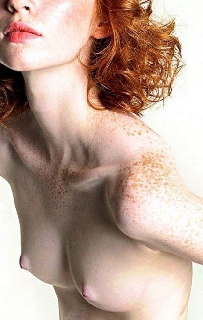 So Many Freckles Porn Pic