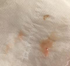 Warning Tmi Pic Opinions Please Implantation Bleeding Or Af Mumsnet