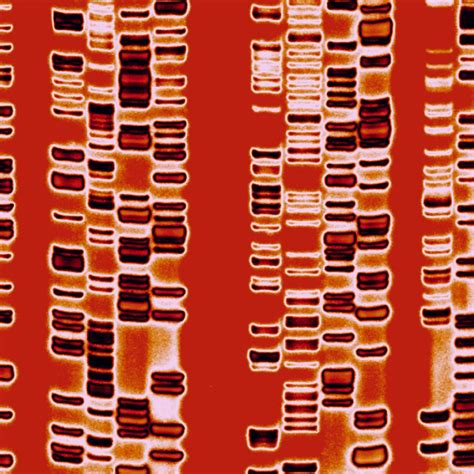 Dna Autoradiogram Artwork Photograph By Mehau Kulyk Fine Art America