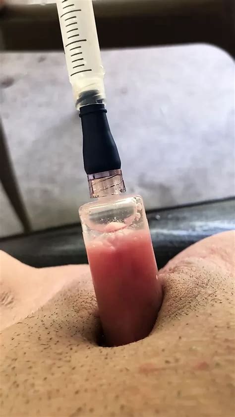 Free Clit Pump Porn Videos Xhamster