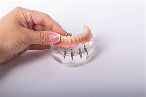 dental implants procedures costs  anesthesia encino dental studios