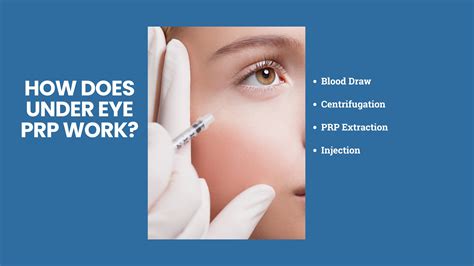 eye prp