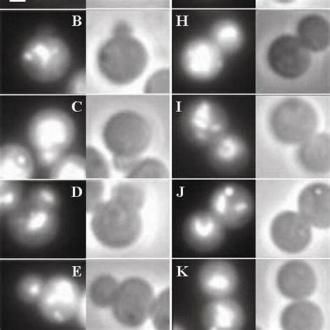 Fluorescence And Phase Contrast Micrographs Of Individual G