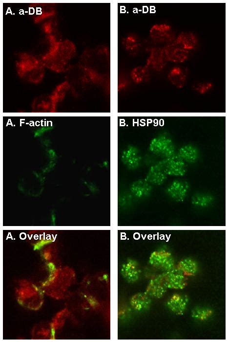 Dual Immunofluorescence Labeling Of Human DB And Actin Filaments