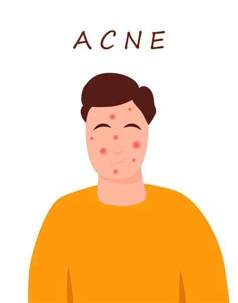 Cartoon Teenage Character With Acne Skin Skin Problems Concept