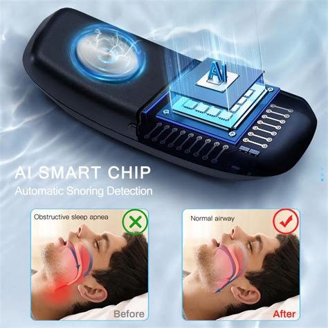 Smart Anti Snoring Device Ems Pulse Snoring Stop Effective Solution