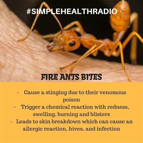 Let Us Know The Allergies And Infections Caused By Fire Ant Bites