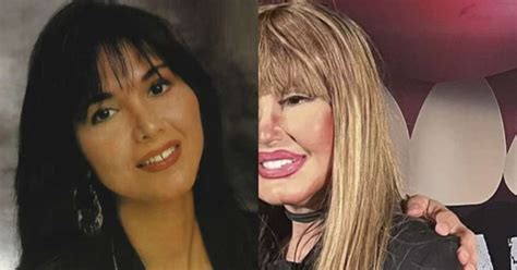 Cantora Rosana Antes E Depois - Hit dos anos 80, Rosana surge irreconhecível e com o rosto inchado