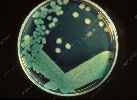 Pseudomonas aeruginosa bacteria - Stock Image - B220/0060 - Science ...