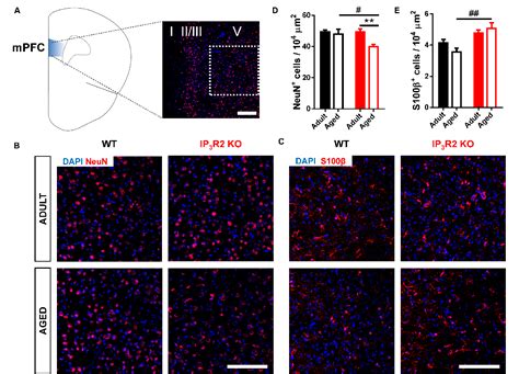 Figure From The Role Of Astrocytic Calcium Signaling In The Aged