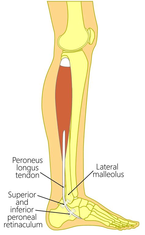 Peroneus Longus Tendonitis: #1 Causes & Best Treatment