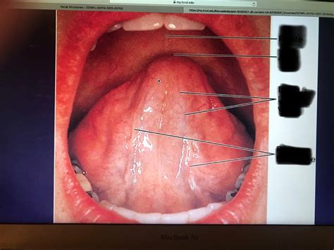 Tongue Anatomy Ventral Surface