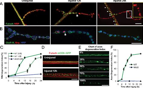 Figure From A Conditioning Lesion Protects Axons From Degeneration